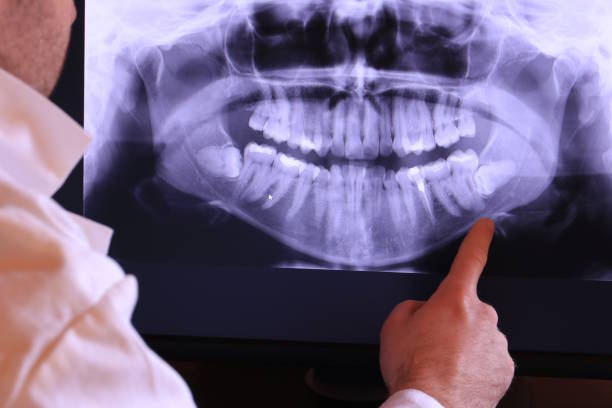 Best Broken or Cracked Tooth Emergency Dentist in West Laurel, MD