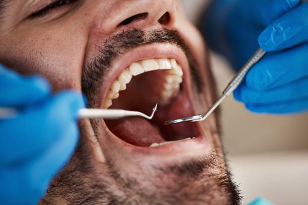 Best Emergency Dental Services for Seniors in West Laurel, MD